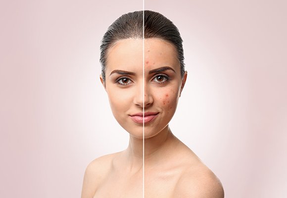 Clinical Dermatology