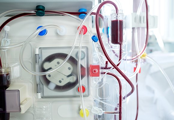 Haemodialysis