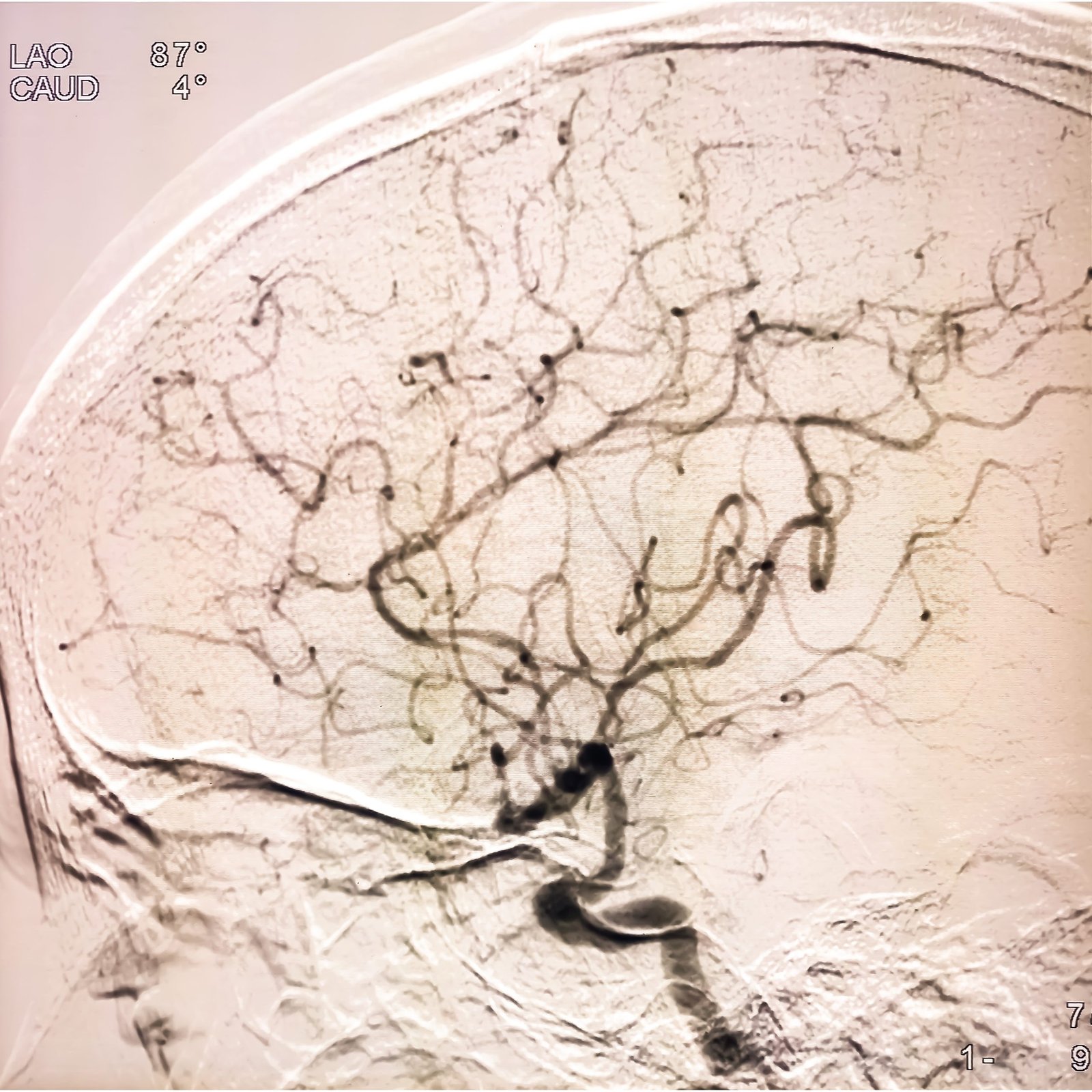 Neuro, Orthopaedic, And Women’s Interventions